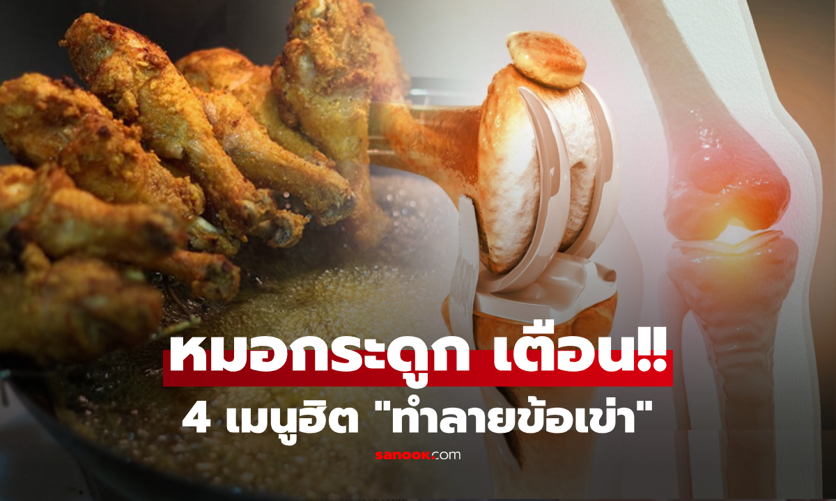 ระวัง!! เดินไม่ได้ตอนแก่ หมอกระดูกเตือน 4 อาหาร \
