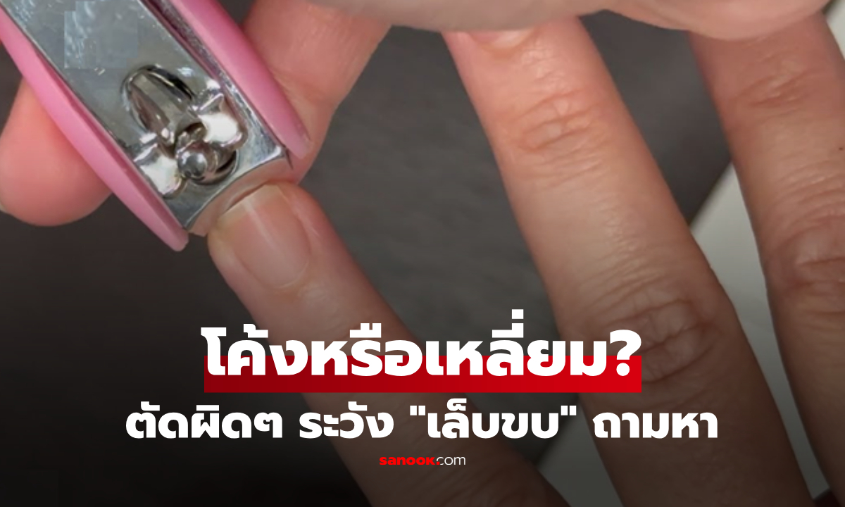 ตัดเล็บโค้งหรือเหลี่ยม? เช็ก 3 จุดพลาด ที่คนส่วนใหญ่ทำประจำ ตัวการนิ้วพัง-เจ็บตัว!!!