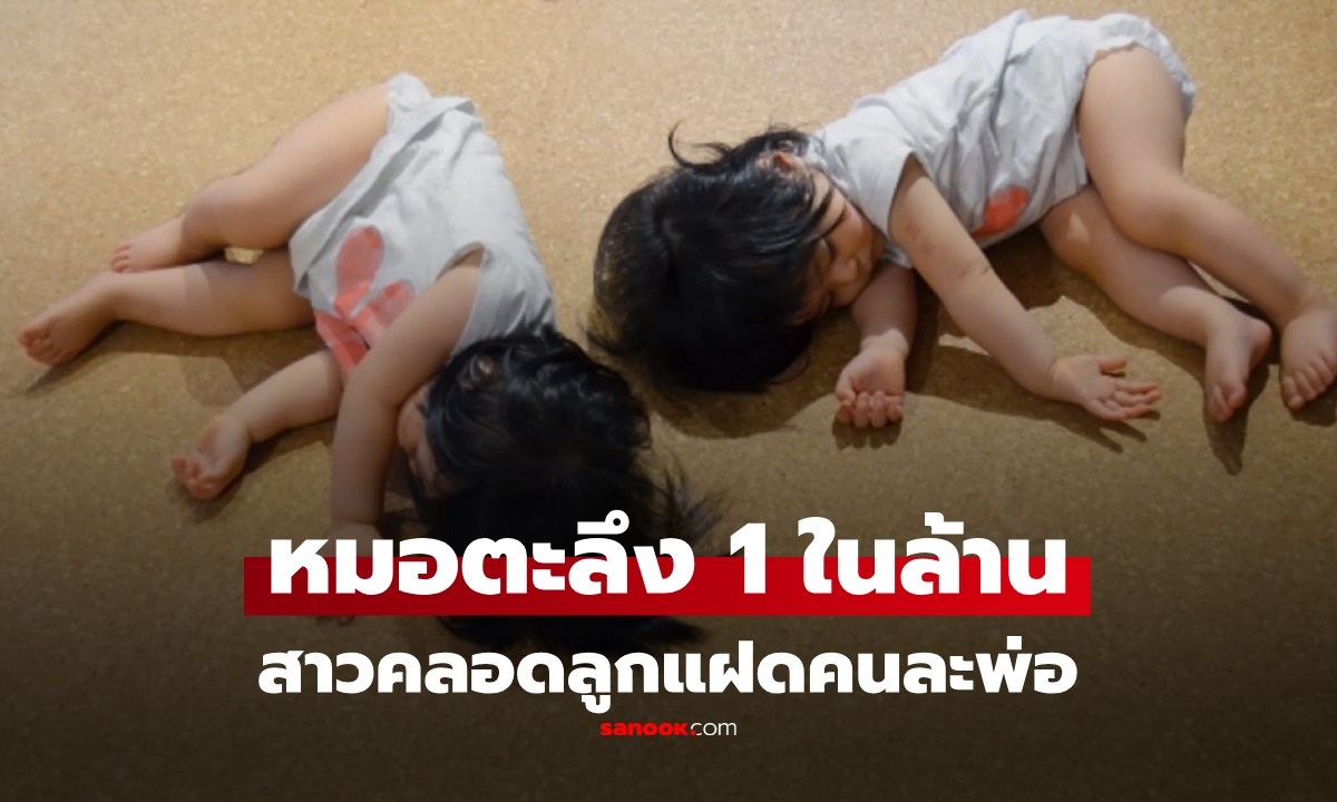 หมอยังช็อก! ปรากฏการณ์ 1 ในล้าน สาวคลอดลูกแฝด "คนละพ่อ" หลังมีเซ็กซ์คืนเดียวกับชาย 2 คน