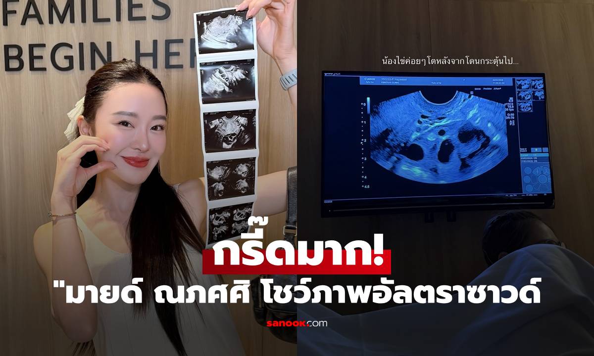 "มายด์ ณภศศิ" กรี๊ดมาก! โชว์ภาพอัลตราซาวด์เผยข่าวดี แฟนๆ คอมเมนต์เพียบ