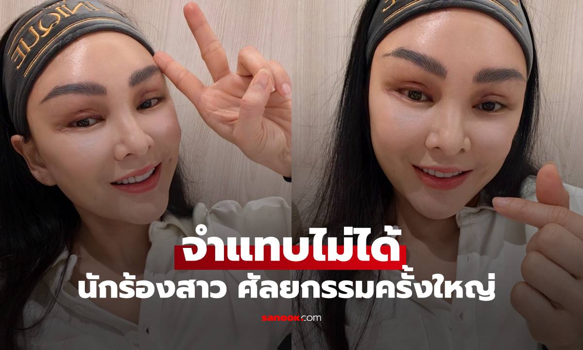 จำแทบไม่ได้! นักร้องสาว ศัลยกรรมครั้งใหญ่ ความสวยฉายแวว หน้าเด็กมาก