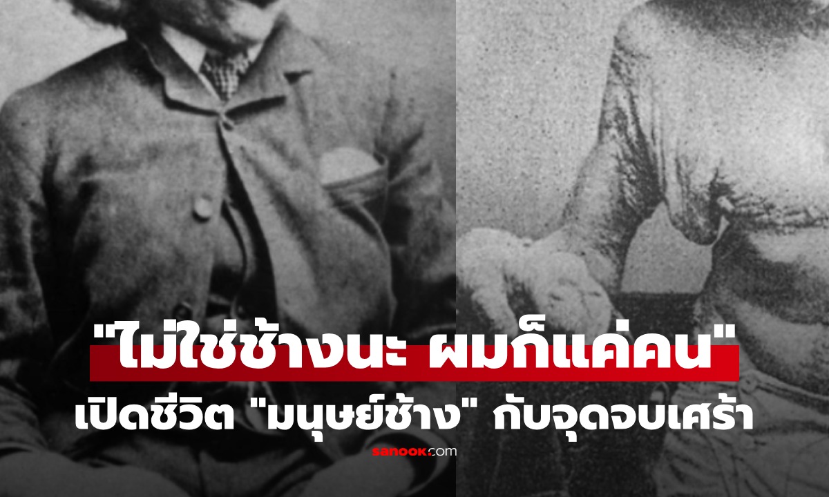 เรื่องจริงยิ่งกว่าหนัง! เปิดชีวิตแสนเศร้า "มนุษย์ช้าง" ชายผู้ถูกสังคมตีตรา "อัปลักษณ์ที่สุดในโลก"