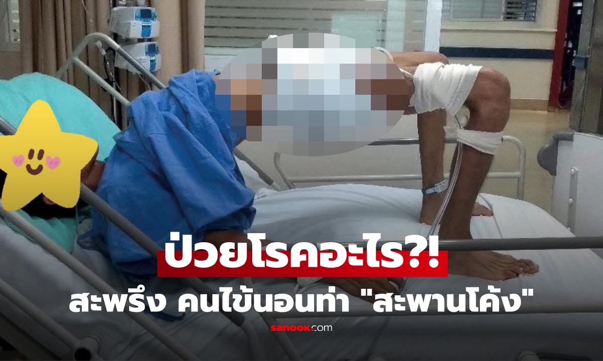 โรคอะไร? ภาพชวนขนลุก คนไข้นอนหลังแอ่น "ท่าสะพานโค้ง" หมอเฉลยป่วยอะไร ยันไม่ใช่เรื่องไกลตัว!