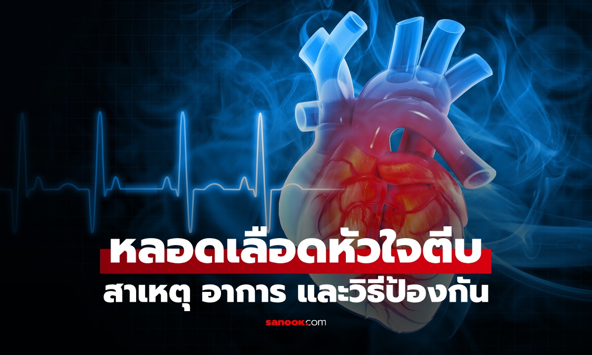 หลอดเลือดหัวใจตีบ ใครบ้างที่เสี่ยง? รู้จักสาเหตุ อาการเบื้องต้น และวิธีป้องกัน