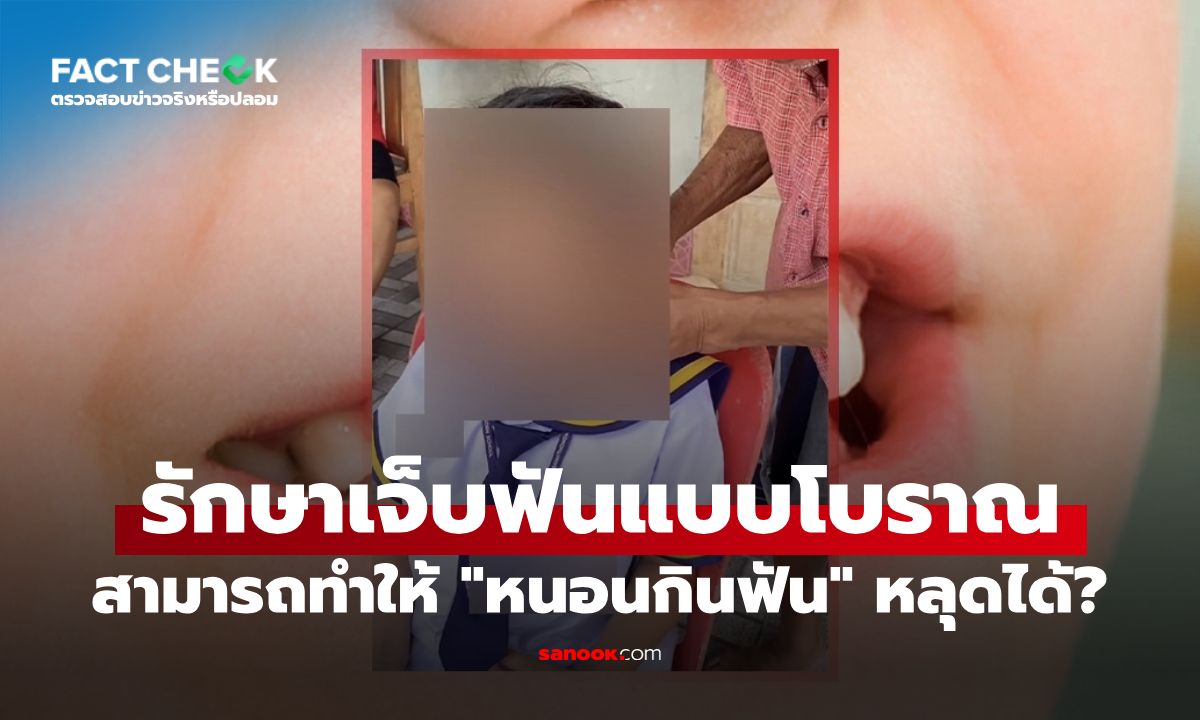 วิธีรักษาอาการเจ็บฟันแบบโบราณ ทำให้ "หนอนกินฟัน" หลุดได้ จริงหรือไม่? : เช็กข่าวชัวร์