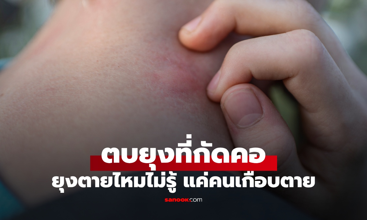 อุทาหรณ์ "ยุงกัดคอ" ตบทีเดียวเข้าห้องฉุกเฉิน ยุงตายไหมไม่รู้ แต่คนเกือบไม่รอด