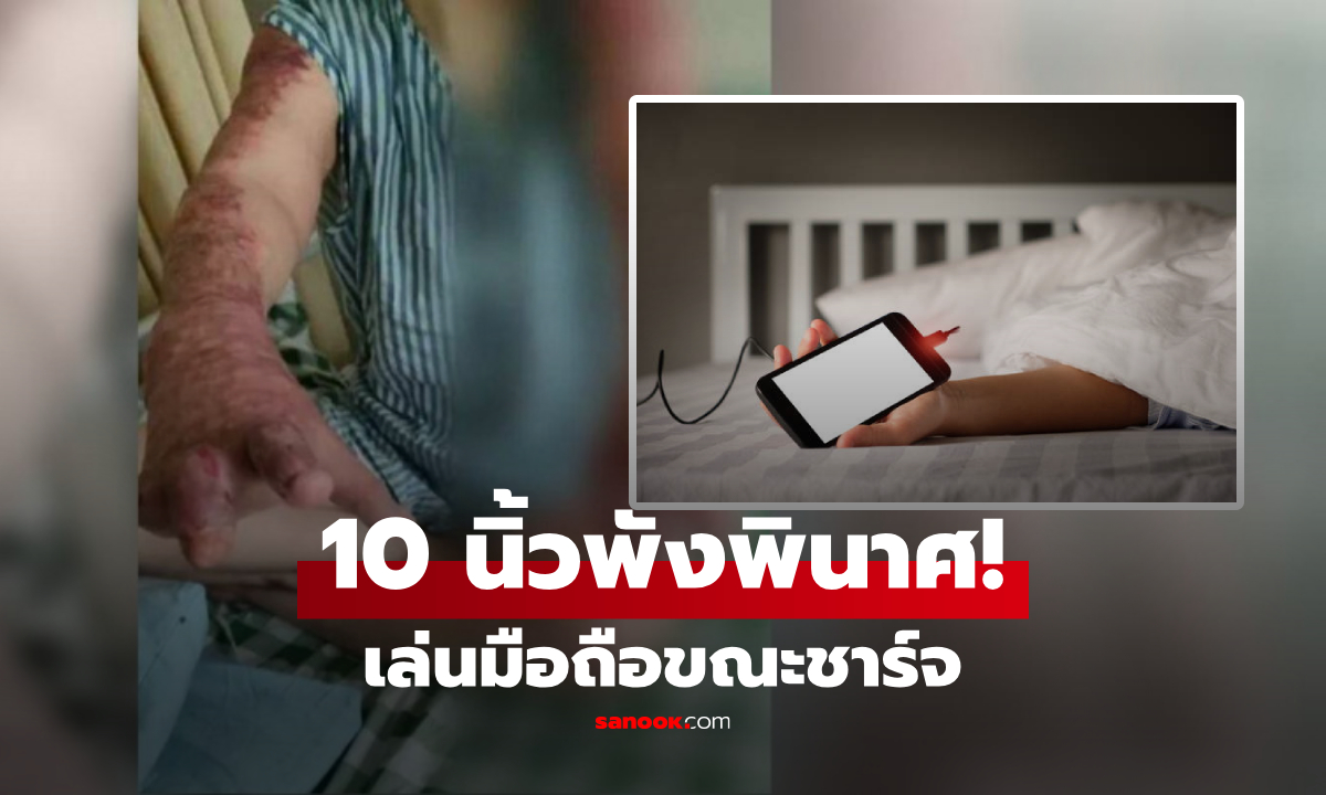 อุทาหรณ์สยอง! เล่นมือถือขณะชาร์จ 10 นิ้วมือ "พังพินาศ" ศาลสั่งผู้ขายชดใช้ 3 ล้าน