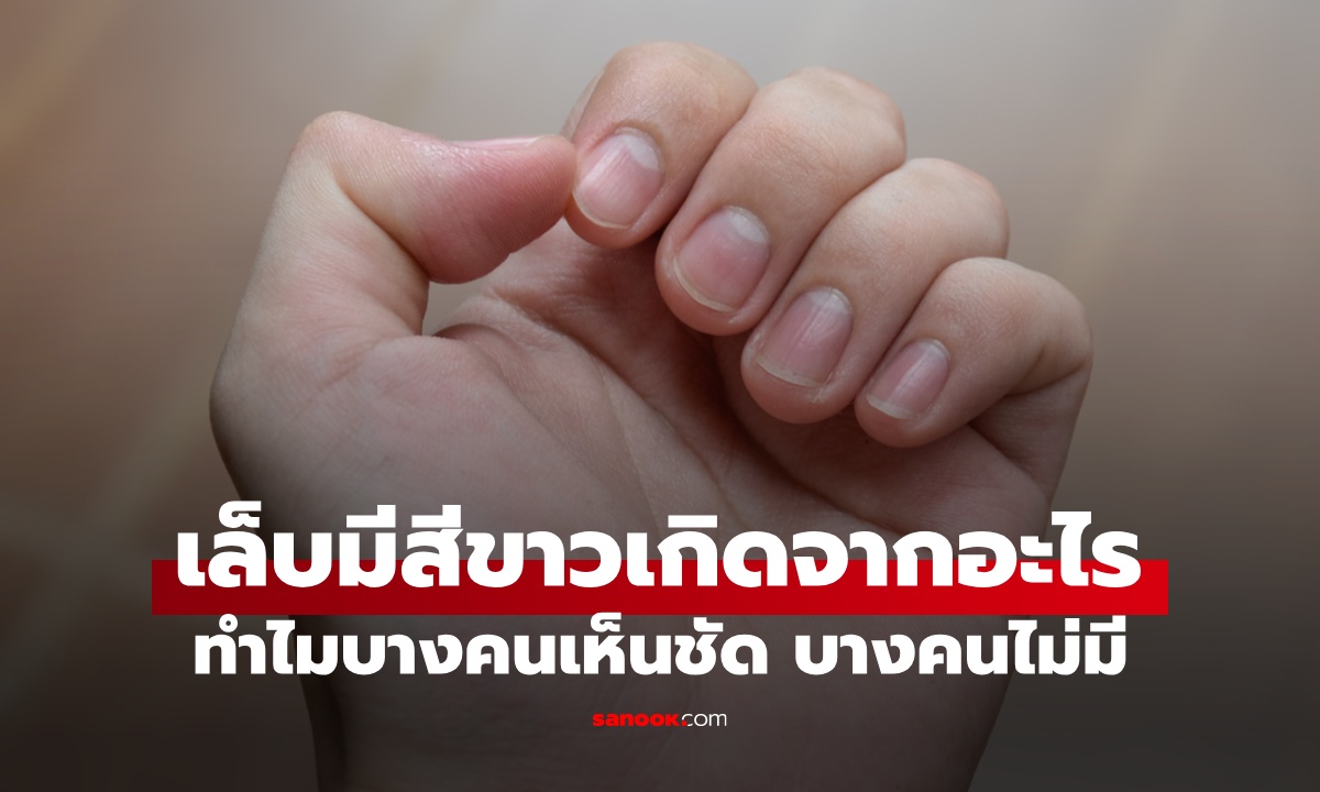 เล็บมีสีขาวเกิดจากอะไร? ทำไมบางคนเห็นชัด บางคนไม่มี แบบไหนอันตราย