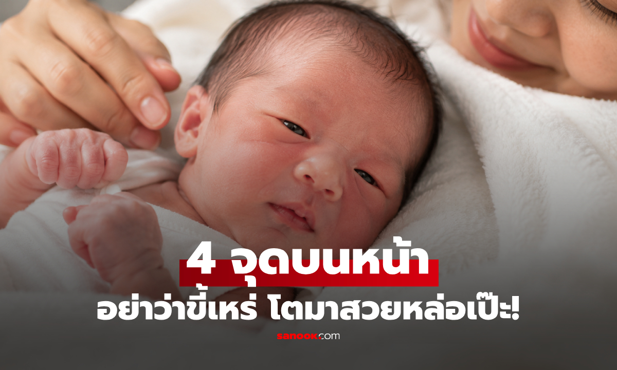 ลูกใครมีบ้าง? เกิดมาพร้อม 4 จุด "ขี้เหร่" บนใบหน้า แต่โตขึ้นรับรองว่าสวยหล่อ!