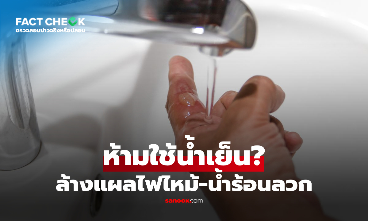 "น้ำเย็นจัด" ห้ามใช้ล้างแผลไฟไหม้-น้ำร้อนลวก? หมอเฉลยพร้อมคำเตือน! : เช็กข่าวชัวร์