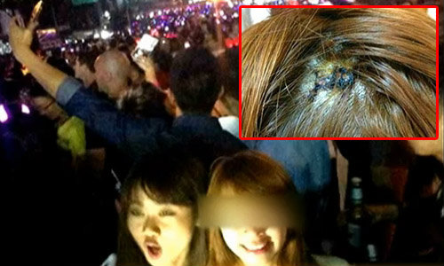 กระสุนปริศนาตกใส่หัวสาวเวียดนาม กลางลาน CTW