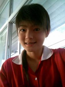 ดิว อริสรา ศัลยกรรม