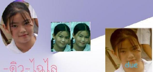 ดิว อริสรา ศัลยกรรม