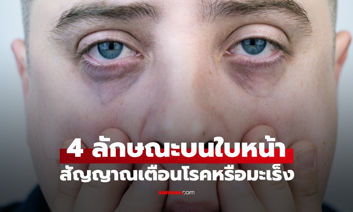 4 ลักษณะบนใบหน้า สัญญาณเตือนโรคหรือมะเร็ง อย่าสับสนกับ 