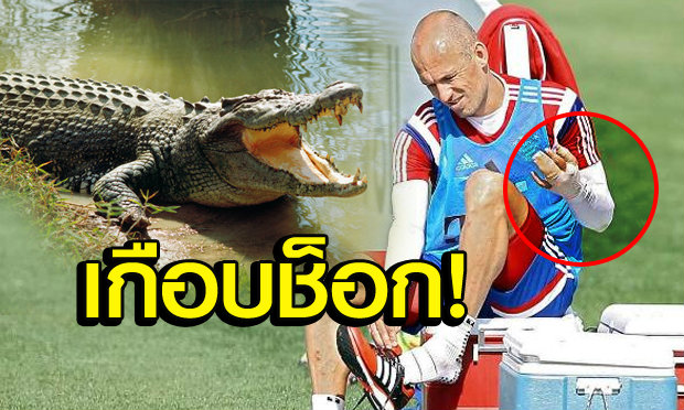 อำแรง”ร็อบเบน”มือเจ็บเพราะโดนไอ้เข้งับที่กาตาร์