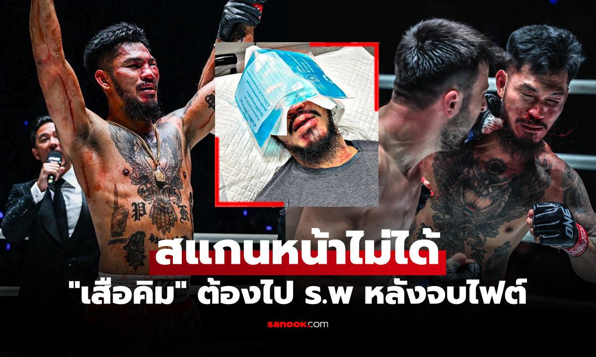 ต้องแลกมา! เปิดสภาพใบหน้า \