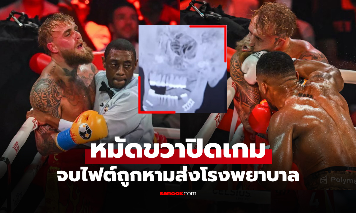 หนักเลย! \